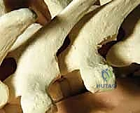 صورة توضيحية لـ تصحيح الجنف بالخطاطيف والأوتاد الفقرية: دليل شامل للمرضى مع الأستاذ الدكتور محمد هطيف