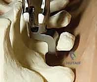 فحص المريض وتقييم التناظر الجسدي