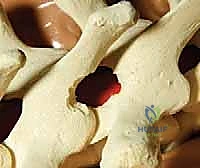 تثبيت الخطاطيف الفقرية