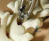 التحقق من التثبيت النهائي