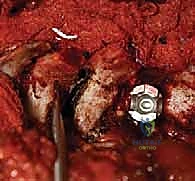 تقييم الأشعة السينية وزاوية كوب