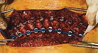 الأستاذ الدكتور محمد هطيف أثناء عملية جراحية دقيقة