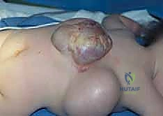 الأدوات الجراحية والتخطيط للعملية