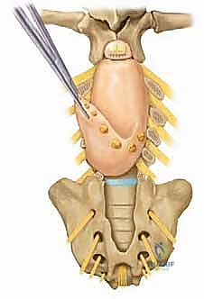 استخدام التقنيات الحديثة في التثبيت