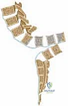 صورة طبية: جراحة استئصال الحداب للقيلة النخاعية السحائية: دليل الأستاذ الدكتور محمد هطيف في صنعاء