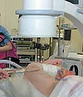 الفحص السريري للجنف واختبار آدمز