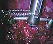 التحضير النفسي والغذائي للمريض