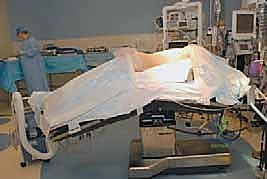 صورة طبية: الدمج الفقري الأمامي مع التثبيت الجراحي للجنف: دليل شامل للمرضى مع الأستاذ الدكتور محمد هطيف