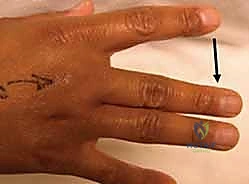 تقييم الحالة في عيادة الدكتور هطيف