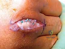 التصوير الشعاعي والموجات الصوتية للتشخيص