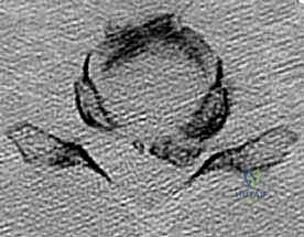 الأدوية والعلاج التحفظي