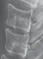 تجهيز المريض والتخدير