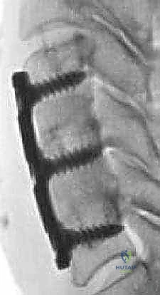 إغلاق الجرح التجميلي