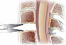 التحضير للعملية الجراحية