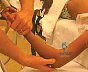 التشريح الدقيق لمفصل المرفق ورأس الكعبرة