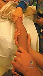 الفحص السريري وتقييم حركة المرفق