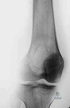 مناقشة الخيارات العلاجية مع المريض بكل شفافية