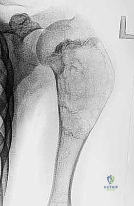 تقييم عوامل الخطر في عيادة الدكتور هطيف بصنعاء