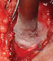 فحص سريري دقيق للمريض لتحديد أعراض الورم