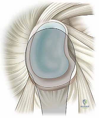 إصابات كتف الرامي بالمنظار: دليلك الشامل مع الأستاذ الدكتور محمد هطيف في صنعاء