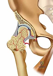 تخطيط جراحي دقيق قبل العملية