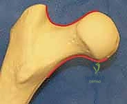 حوادث الطاقة العالية وتأثيرها على الشباب