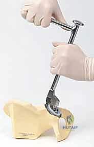 صورة توضيحية لـ إتقان جراحة مراجعة استبدال مفصل الورك: دليل شامل لإزالة المكونات الثابتة بإحكام