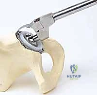 صورة طبية: إتقان جراحة مراجعة استبدال مفصل الورك: دليل شامل لإزالة المكونات الثابتة بإحكام