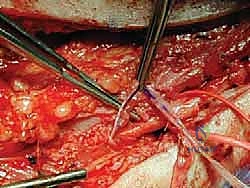 الأستاذ الدكتور محمد هطيف رائد جراحة العظام والأعصاب الطرفية في اليمن