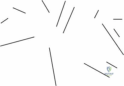 تأثير التهاب المفاصل الروماتويدي على الأوتار