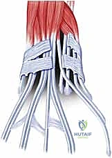 صورة توضيحية لـ استئصال الغشاء الزليلي للأوتار القابضة والباسطة في اليد: دليل شامل للمرضى مع الأستاذ الدكتور محمد هطيف