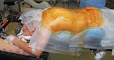 خطوات الفحص السريري للجنف