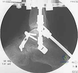 تقييم المريض قبل الجراحة