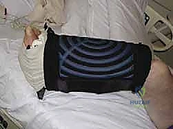 الأشعة السينية للكاحل قبل العملية