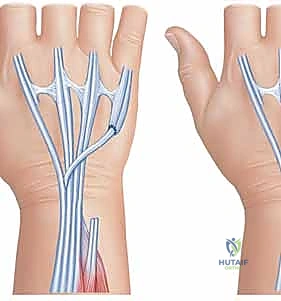 التشخيص بالأشعة والموجات الصوتية
