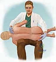 جدول التقييم والعلاج