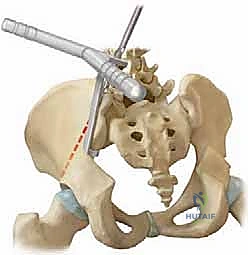 الأستاذ الدكتور محمد هطيف أثناء الجراحة
