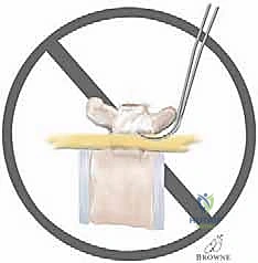 التخطيط الدقيق قبل الجراحة