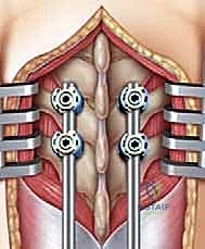 عملية إطالة قضبان النمو الدورية