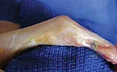 التشريح الدقيق لأوتار ومفاصل اليد