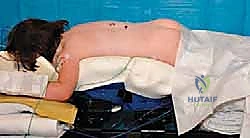 صورة مقطعية CT توضح التشريح العظمي للفقرة النصفية