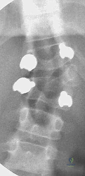 تجهيز المريض والمراقبة العصبية