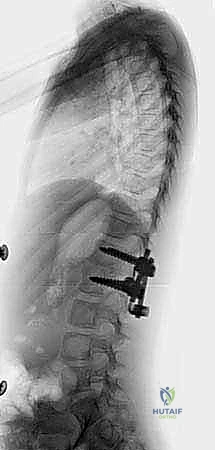 Clinical Image