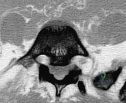 أشعة مقطعية تستخدم في التخطيط الجراحي الدقيق