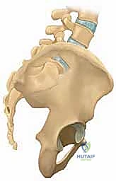 تركيب المسامير العنيقية في تقنية الدمج الخلفي الجانبي