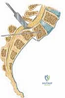 الدكتور محمد هطيف أثناء إجراء تدخل جراحي دقيق في العمود الفقري