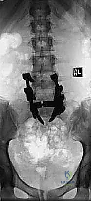 الأستاذ الدكتور محمد هطيف أثناء مناقشة خطة العلاج مع فريقه الطبي