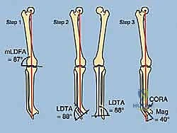 الدكتور محمد هطيف أثناء التخطيط الجراحي