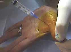 استخدام التقنيات الحديثة في التشخيص