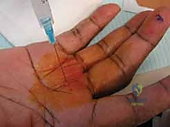 الفحص السريري الدقيق في عيادة د. هطيف